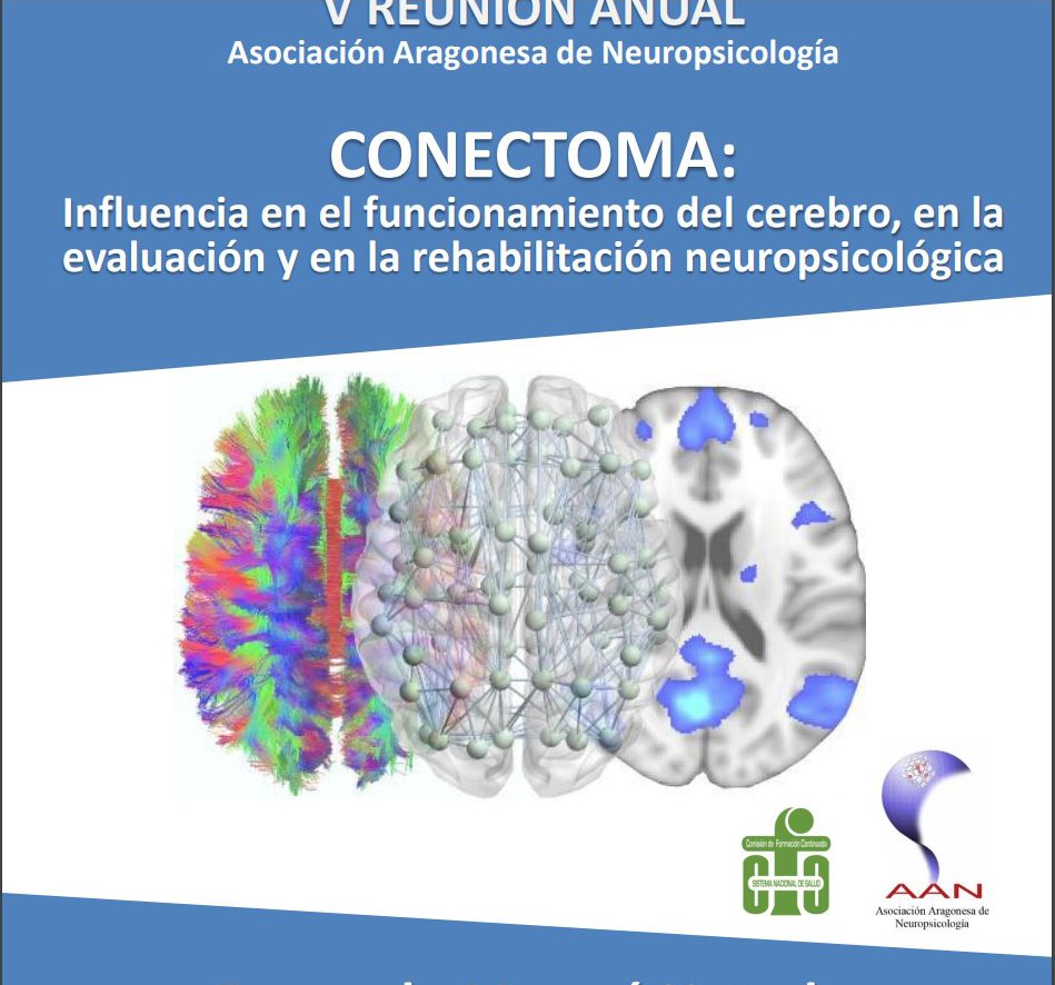 EL HOMBRE ESCULTOR DE SU CEREBRO – Ateneu Castelló